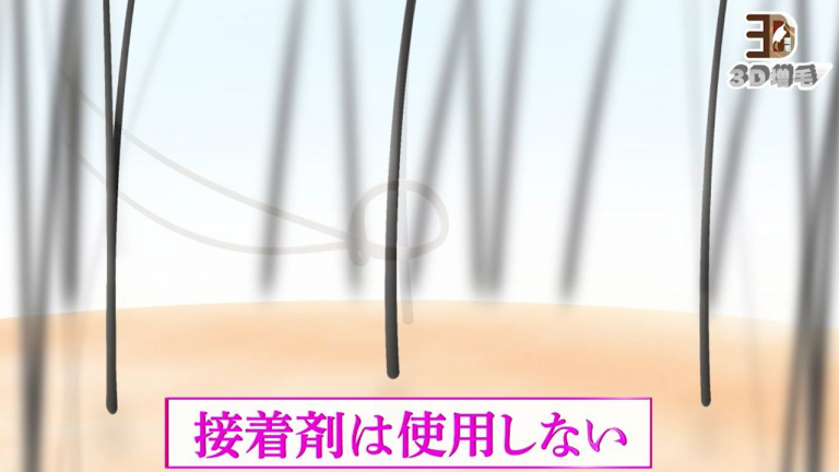 ３D増毛の人気の秘密